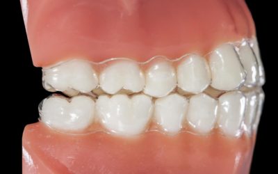 Dental Occlusion