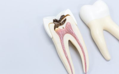 Endodontic Treatment under the Microscope